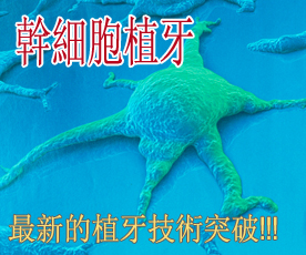 Arrange a stem-cell-implant Arrange a stem-cell-implant
